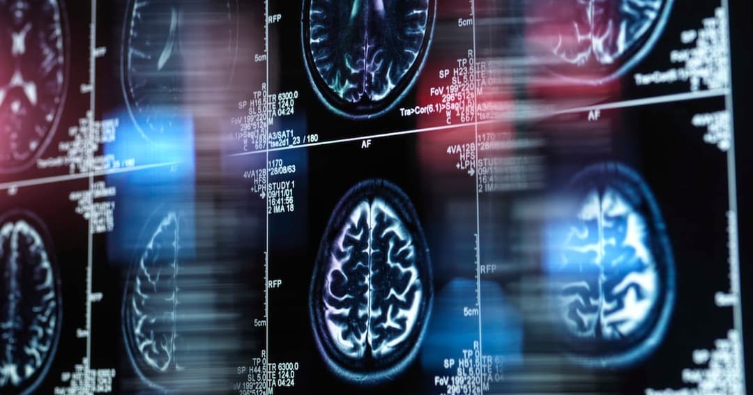 دراسة تكشف تأثير الملخصات المدعومة بالذكاء الاصطناعي على الذاكرة